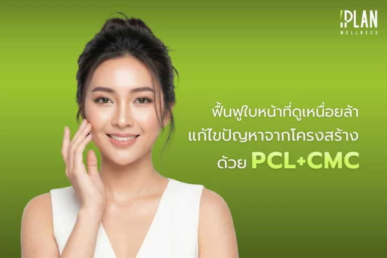 ฟื้นฟูใบหน้าเหนื่อยล้า แก้ไขปัญหาจากโครงสร้างด้วย PCL+CMC